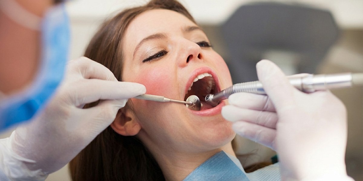 Expert Dental Fillings in Bourne, MA