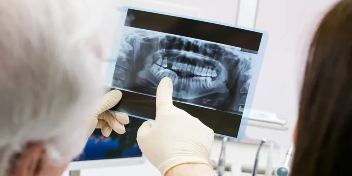 Dental X-Rays