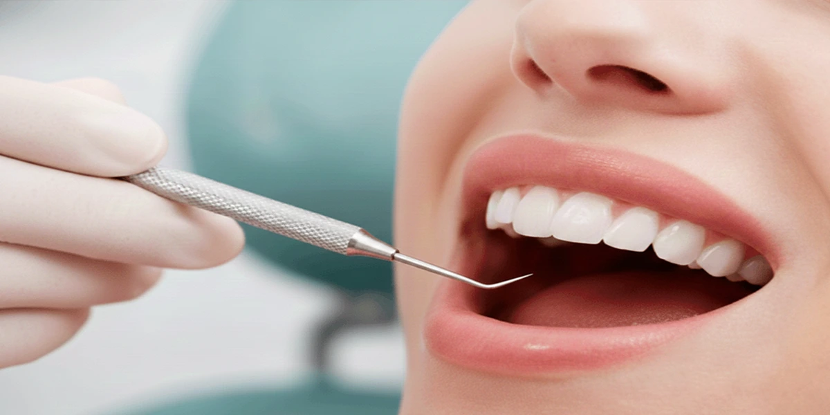 Scaling & Root Planing